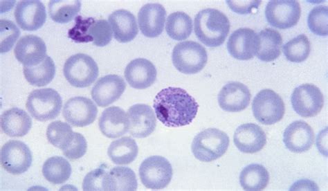 Plasmodium Vivax Scientists Against Malaria