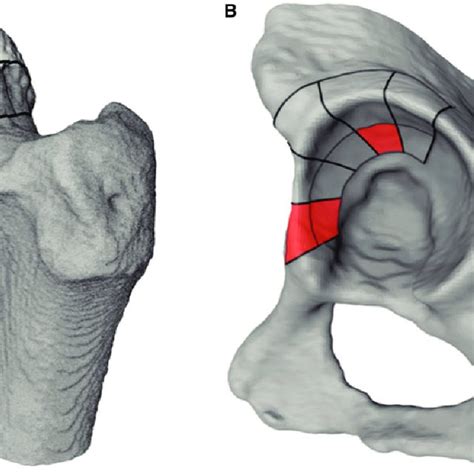 Femur And Acetabular Bone Sections Defined By Segmentation Of The Ct Download Scientific