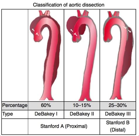 Aortic Dissection Core Em