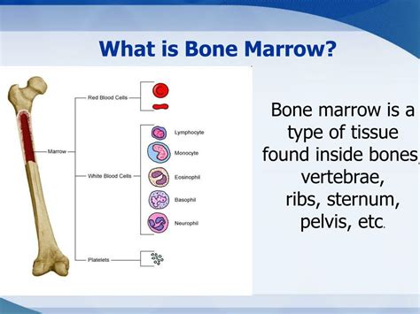 Ppt An Overview Of The Bone Marrow Donation Process Powerpoint