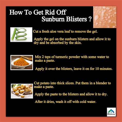 How To Get Rid Off Sunburn Blisters