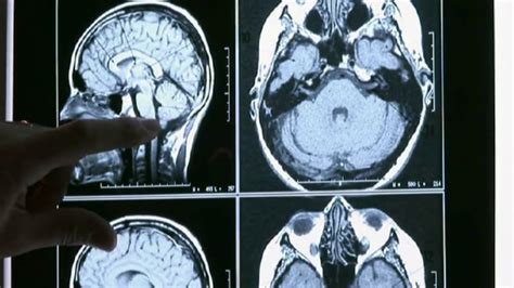 Wajah keluarga adalah cermin ajaib. Kisah Keluarga Ini yang Memiliki 5 Anak Berjalan Menggunakan Kaki dan Kedua Tangannya | KASKUS