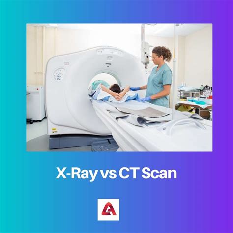 X Ray Vs Ct Scan Difference And Comparison