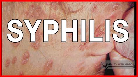 Syphilis Symptoms Stages Of Syphilis Causes And Treatment Youtube