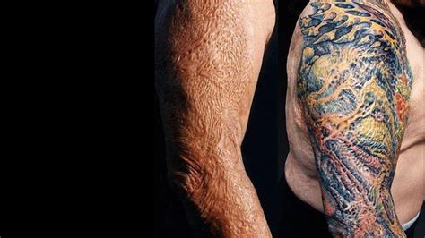 The Firefighter Who Got A Tattoo Over His Skin Graft The