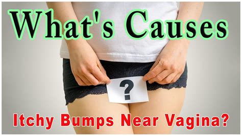Whats Causing Itchy Bumps Near My Vagina Vagina Infection Vulvar Cancer Footloose Youtube