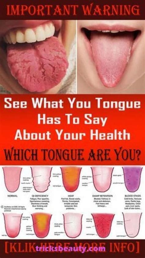 What Your Tongue Is Trying To Tell You About Your Health In 2020