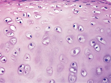 Histology Of Human Cartilage Connective Tissue Show Hyaline And Hot