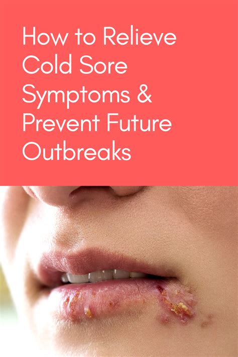 Cold Sore Sufferers Know The Signs A Cold Sore Outbreak Is Coming