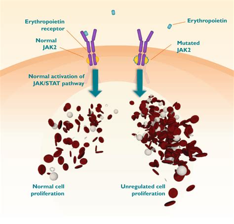 Trt And Erythrocytosis Facts And Recommendations The Mens Health Clinic