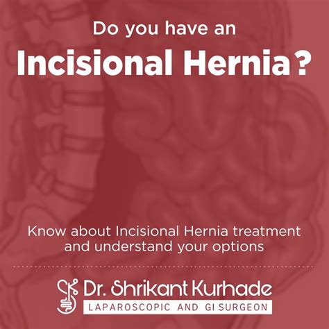 Dr Shrikant Kurhade Laparoscopic Gastroenterologist Bariatric Hernia