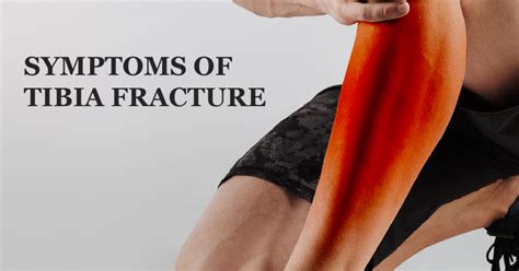What Is A Tibia Fracture Welcome To Sys Medtech International Pvt Ltd