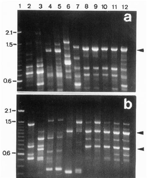 Random Amplified Polymorphic Dna Patterns Obtained With Primers A