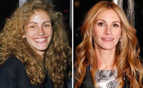 Julia Roberts Shocking Plastic Surgery Scandals The Buzz Around Her Fascinating Yet Fake Beauty