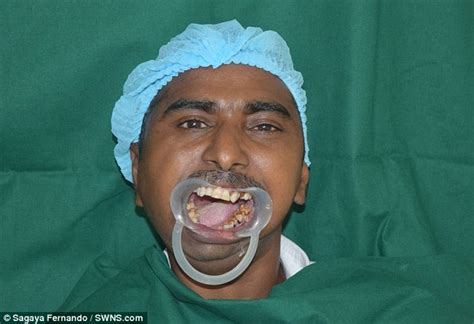 Malnourished Indian Man Eats Solid Food For The First Time Daily Mail