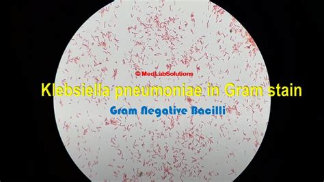 Klebsiella Pneumoniae In Gram Staining Youtube