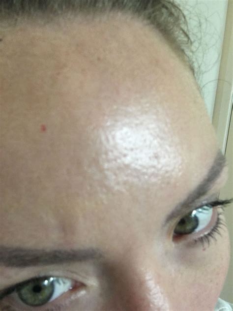 Small Holes On My Face Beauty Insider Community