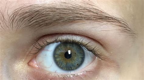 Blue Gray With Central Heterochromia 💙 Eyes