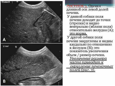 Печень желчный пузырь диету ПЕЧЕНЬ и ЖЕЛЧНЫЙ ПУЗЫРЬ ЧАСТЬ 2 Выполнила студентка ПЕЧЕНЬ и ЖЕЛЧНЫЙ ПУЗЫРЬ ЧАСТЬ 2 Выполнила студентка Печень желчный пузырь диету
