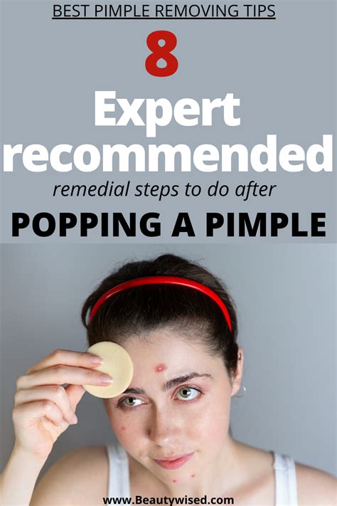How To Pop A Pimple Under The Skin Guide At How To