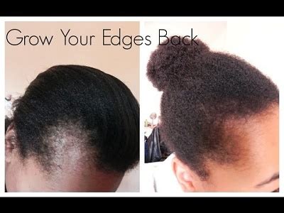Facebook february 12 at 6:33 pm · 2020 my before and after i use both the white and yellow bottle it's been a year since i've been using them i would high recommend. How to Use Jamaican Black Castor Oil for Hair Growth ...