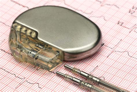 Fda Warns Surgeons Of Potential Risks With Medtronic Micra Leadless