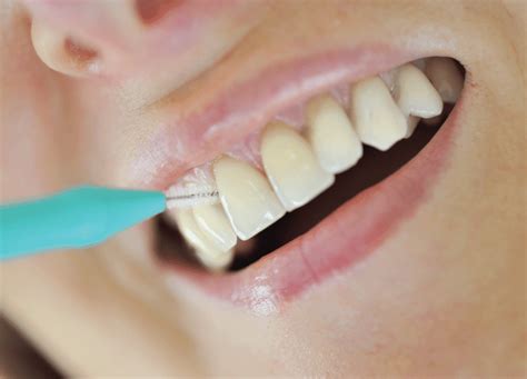 How To Clean In Between Teeth Meeks Upip1979