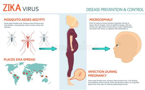 The Risk For Pregnant Women Zika Virus Alert Stock Vector Illustration Of Aedes Aegypti
