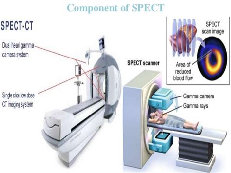 Spect With Clinical Application