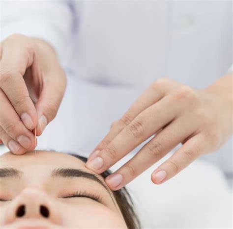 Facial Rejuvenation Acupuncture Rose Wellness