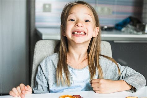 Cute Little Blond Girl With Missing Front Teeth Looking At The Camera