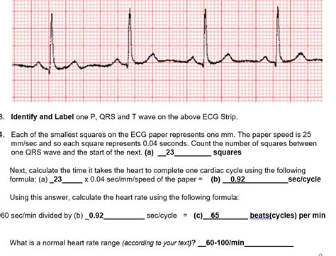 Solved 6 Measure This Strips Pr Interval In Mm By