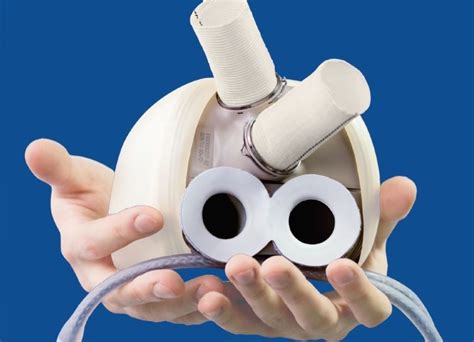 Carmat Implants Aeson Artificial Heart To 39 Year Old Us Patient