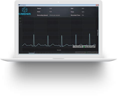 Dynamic Wpf Visualization Of Ecg Signals In Realtime Scichart The Best Porn Website