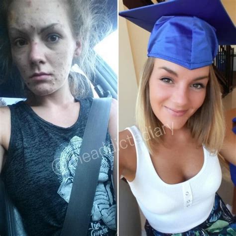 Recovering Meth Addict Shares Incredible Before And After Photos