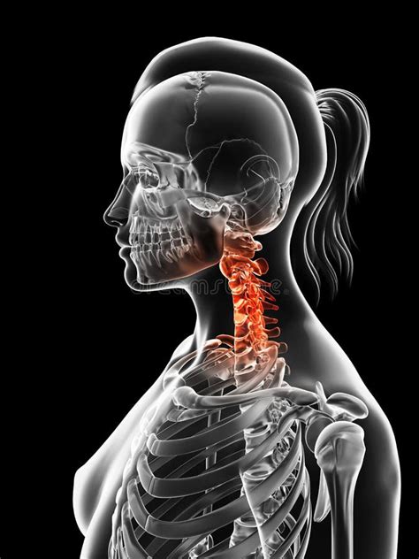 Highlighted Cervical Spine Stock Illustration Illustration Of Injury