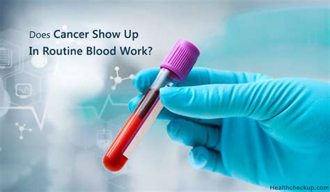 Does Cancer Show Up On Routine Blood Tests Cancerwalls