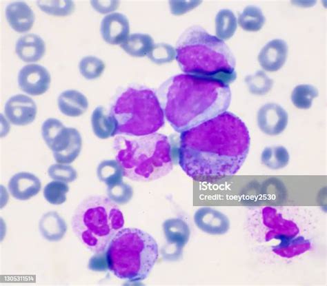 Immature Cells In Myeloid Serie Myelocyte Metamyelocyte Stock Photo