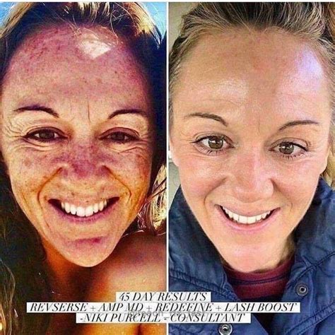 Look At Her Shocking Before And After 😱 So Much Sun Damage But With