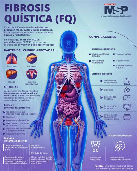 Fibrosis Quistica Infografía