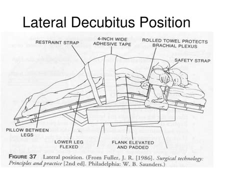 Lldp is defined as left lateral decubitus position rarely. PPT - Positioning the Surgical Pt Pt. II PowerPoint ...