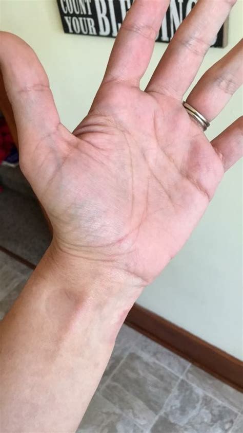 Easy To See Veins In My Palm And Wrist Wrist Jewelry Rings