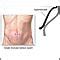 We did not find results for: Diagnostic laparoscopy: MedlinePlus Medical Encyclopedia