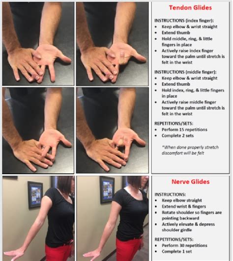 Exercise Prescription A And B Tendon Gliding Exercises Performed For