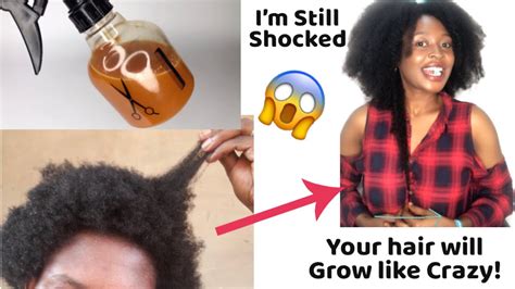 Use This For 10 Times Faster Hair Growth Youtube