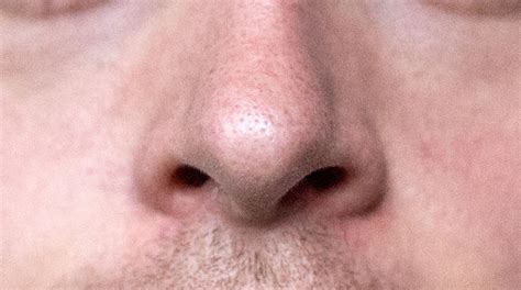 Nose Understanding Nasal Anatomy Inside View Saint Luke S Health
