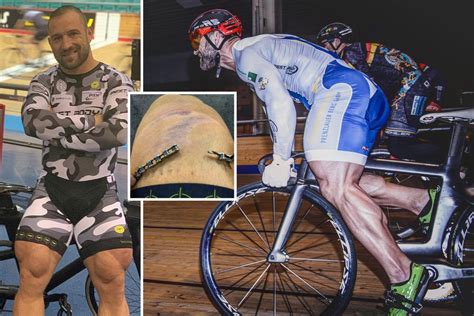 Quadzilla Cyclist Robert Forstermann Has Freak 74cm Thighs And Is So