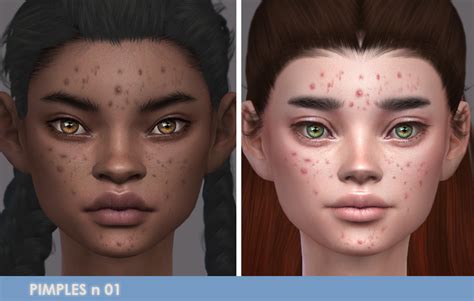 Sims 4 Pimples