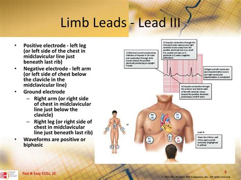 Ppt 12 Lead Ecgs And Electrical Axis Powerpoint Presentation Free
