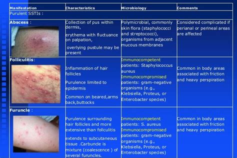 Management Of Skin And Soft Tissue Infections With Ayurveda Wsr Ra